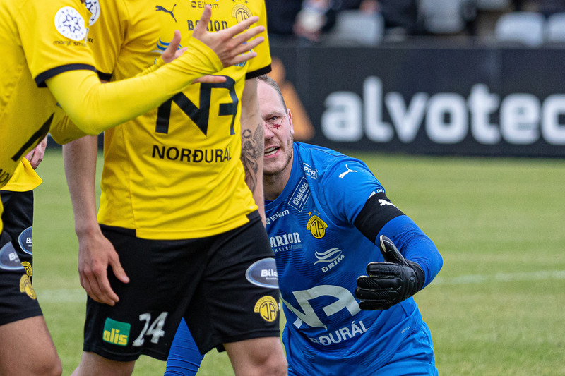 Myndir: Árni Snær fékk stóran skurð í andliti gegn KR