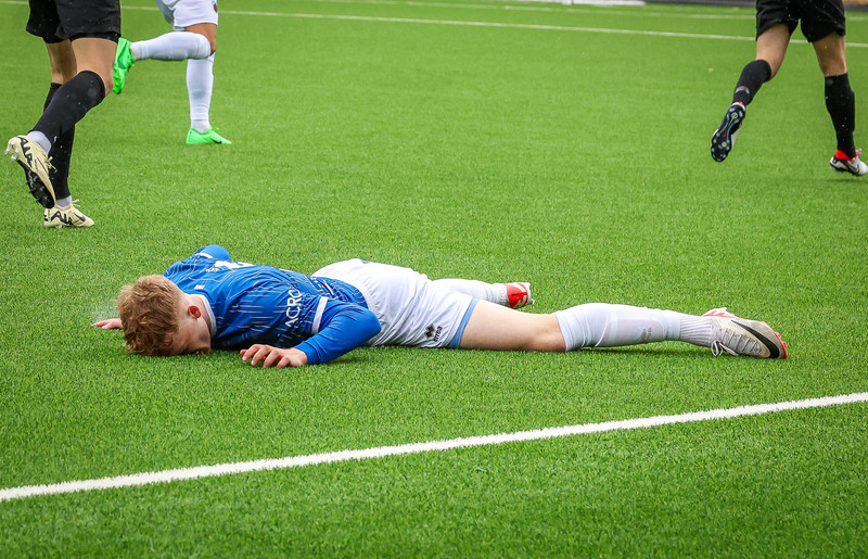 Blóðugur eftir samstuð við liðsfélaga