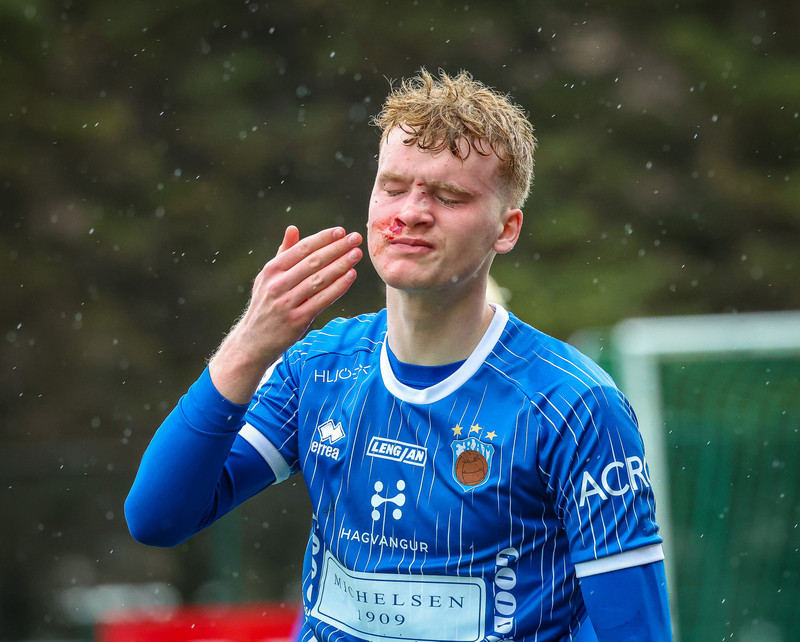 Blóðugur eftir samstuð við liðsfélaga